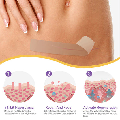 ✅Official Store |SEAGRIL® Hyaluronic Acid Nano Microneedle Repair Tape🏥(Treatment of old and new scars, reduction of surgical scars, stretch marks, keloids, acne, burns, warts, dermatomes and varicose veins)