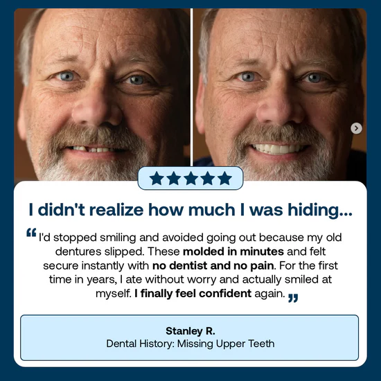 🎁Ends Today: 70% OFF! ⏰Yagoo™ Medical Full Denture with Strong Suctiond🦷Obtain American Dental Association (ADA) Certification