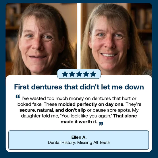 🎁Ends Today: 70% OFF! ⏰Yagoo™ Medical Full Denture with Strong Suctiond🦷Obtain American Dental Association (ADA) Certification